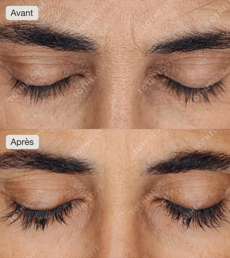 Best serum for sparse and thin eyelashes