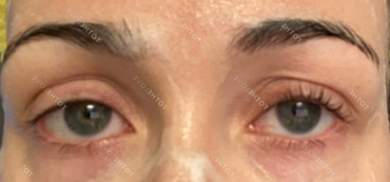 Before Image